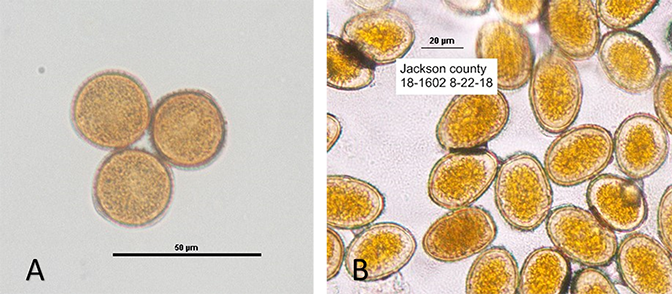 Figure 1. A - Common rust spores. B - Southern rust spores from sample taken in Jackson County. (Source: PPDL)