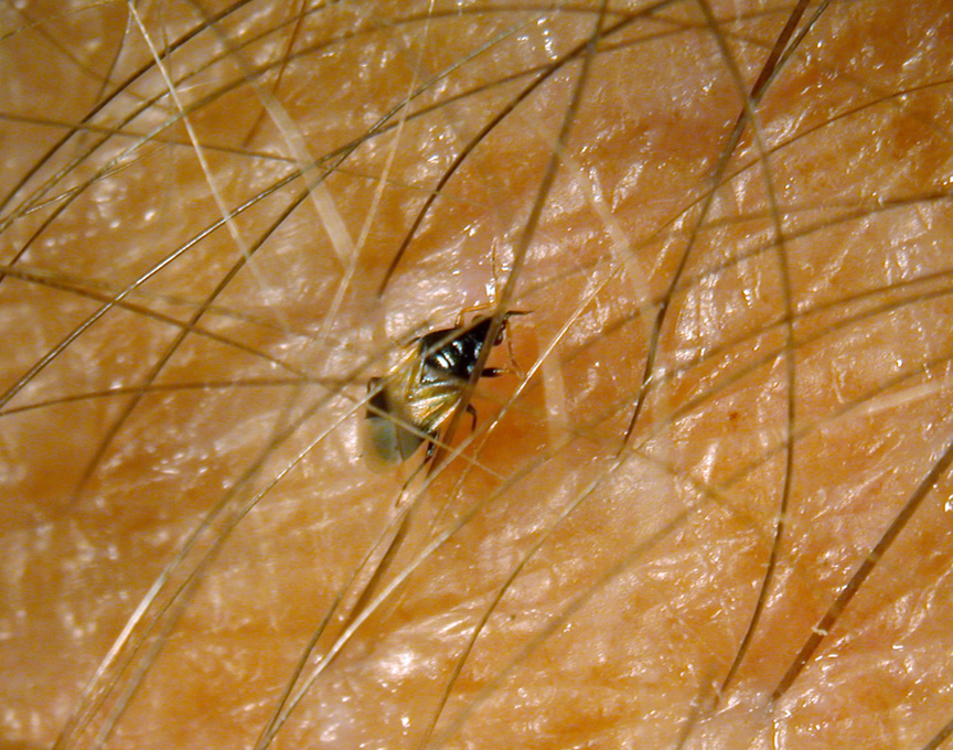 Little Black Bug…BIG Bite | Purdue University Pest&Crop newsletter