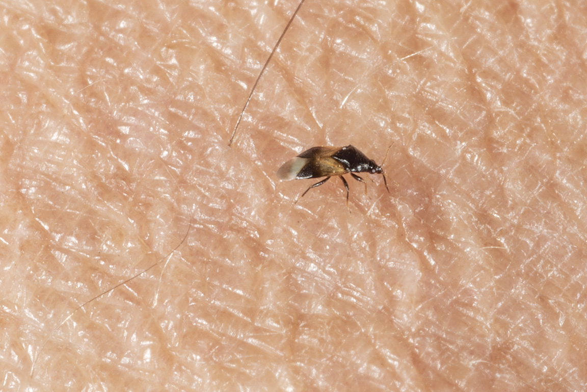 Tiny Flying Bugs In My House That Bite Psoriasisguru Com   OriusSideBitingSkinClose72 