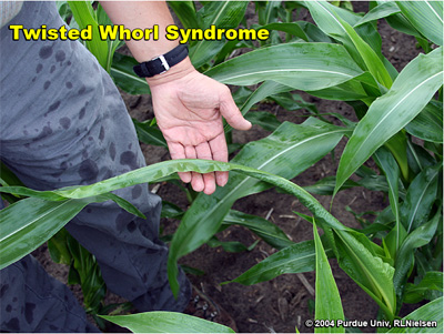 Twisted whorl syndrome