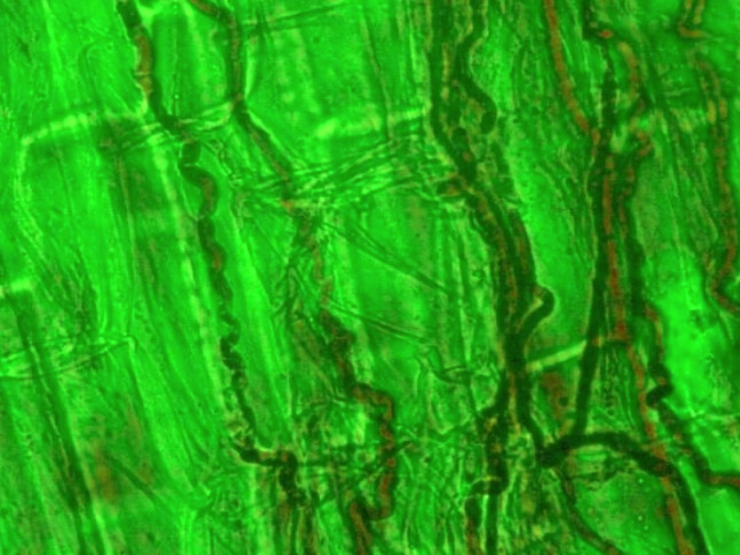 Figure 13. The fungal endophyte Epichloë festucae in tall fescue. Note the darker stained fungal hyphae growing between the plant cells.