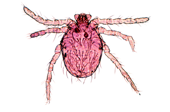 Chigger <em>Eutrombicula alfreddug</em> (Oudemans)