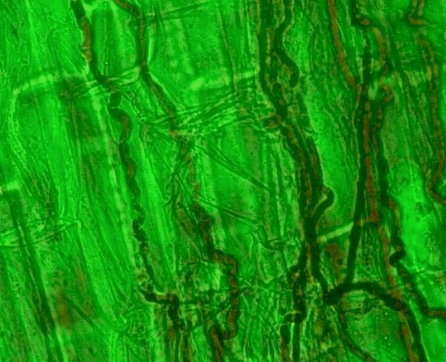 Figure 1. The fungal endophyte <em>Neotephodium coenophialum</em> in tall fescue. Note the darker stained fungal hyphae growing between the plant cells.