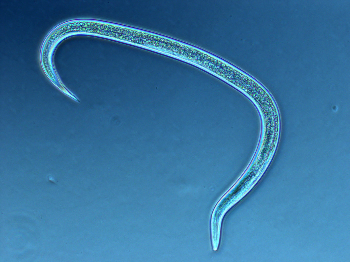 Figure 2. Infective juvenile of the insect parasitic nematode Steinemema carpocapsae, a common biological contgrol agent of above-ground turfgrass insects.
