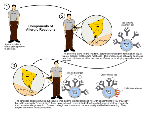 Steps Involved in Immediate Hypersensitivity